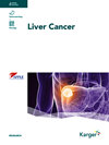 Liver Cancer